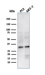 Anti-NKX2.8 antibody [NKX28/3233R] used in Western Blot (WB). GTX02689