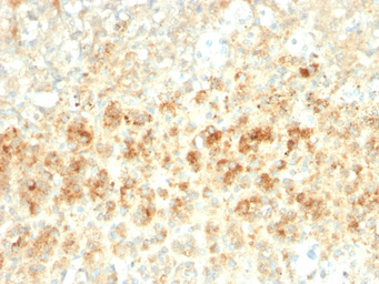 Anti-ADFP antibody [ADFP/2755R] used in IHC (Paraffin sections) (IHC-P). GTX02691