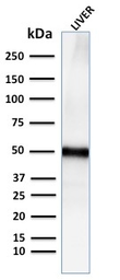 Anti-ADFP antibody [ADFP/2755R] used in Western Blot (WB). GTX02691