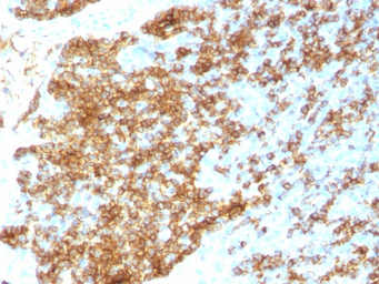 Anti-CD45RB antibody [PTPRC/1783R] used in IHC (Paraffin sections) (IHC-P). GTX02698