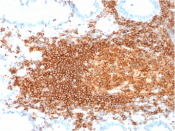 Anti-CD45RB antibody [rPTPRC/1132] used in IHC (Paraffin sections) (IHC-P). GTX02699