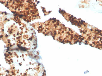 Anti-S100P antibody [S100P/4386R] used in IHC (Paraffin sections) (IHC-P). GTX02704
