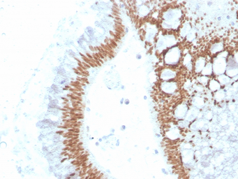 Anti-SATB2 antibody [SATB2/4374R] used in IHC (Paraffin sections) (IHC-P). GTX02705