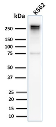 Anti-alpha 1 Spectrin antibody [SPTA1/2939R] used in Western Blot (WB). GTX02715