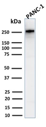 Anti-SPTBN2 antibody [SPTBN2/2894R] used in Western Blot (WB). GTX02716