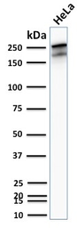 Anti-SPTBN2 antibody [SPTBN2/2894R] used in Western Blot (WB). GTX02716