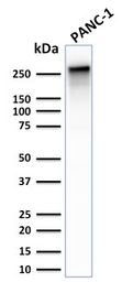 Anti-SPTBN2 antibody [SPTBN2/2887R] used in Western Blot (WB). GTX02717