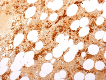 Anti-CD71 antibody [TFRC/2898R] used in IHC (Paraffin sections) (IHC-P). GTX02719