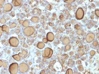 Anti-Thyroglobulin antibody [TGB/1970R] used in IHC (Paraffin sections) (IHC-P). GTX02720