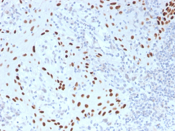 Anti-p63 antibody [TP40/3980R] used in IHC (Paraffin sections) (IHC-P). GTX02728