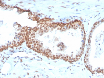 Anti-p63 antibody [TP40/3980R] (Biotin) used in IHC (Paraffin sections) (IHC-P). GTX02731