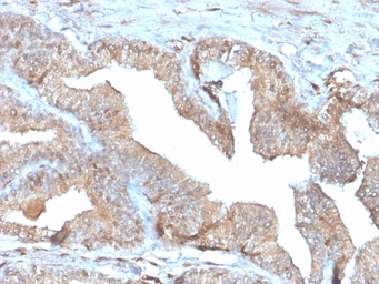 Anti-Thymidine Phosphorylase antibody [rTYMP/3444] used in IHC (Paraffin sections) (IHC-P). GTX02733