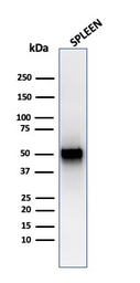 Anti-Thymidine Phosphorylase antibody [rTYMP/3444] used in Western Blot (WB). GTX02733
