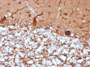 Anti-PGP9.5 antibody [UCHL1/4556R] used in IHC (Paraffin sections) (IHC-P). GTX02737