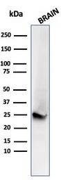 Anti-PGP9.5 antibody [UCHL1/4556R] used in Western Blot (WB). GTX02737