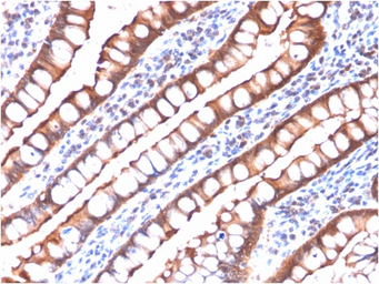 Anti-Villin antibody [rVIL1/1325] used in IHC (Paraffin sections) (IHC-P). GTX02738