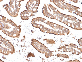 Anti-Villin antibody [rVIL1/1325] used in IHC (Paraffin sections) (IHC-P). GTX02738