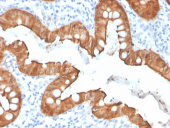 Anti-Villin antibody [VIL1/4107R] used in IHC (Paraffin sections) (IHC-P). GTX02739