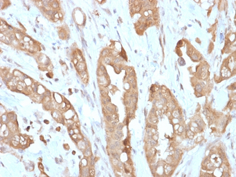 Anti-Villin antibody [VIL1/2310R] used in IHC (Paraffin sections) (IHC-P). GTX02740