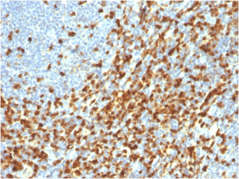 Anti-ZAP70 antibody [ZAP70/3921R] used in IHC (Paraffin sections) (IHC-P). GTX02745