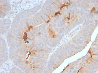 Anti-SAA1 + SAA2 antibody [SAA/2868R] used in IHC (Paraffin sections) (IHC-P). GTX02754