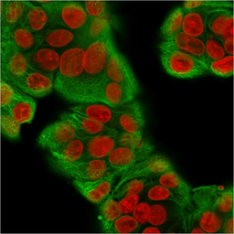 Anti-pan Cytokeratin antibody [KRT/1877R] used in Immunocytochemistry/ Immunofluorescence (ICC/IF). GTX02756
