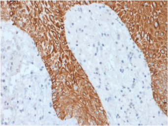 Anti-pan Cytokeratin antibody [KRT/1877R] used in IHC (Paraffin sections) (IHC-P). GTX02756
