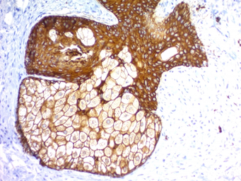 Anti-pan Cytokeratin antibody [KRTH/1576R + KRTL/1577R] used in IHC (Paraffin sections) (IHC-P). GTX02757