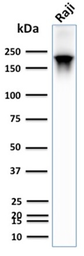 Anti-CD45RB antibody [PTPRC/2877R] used in Western Blot (WB). GTX02760