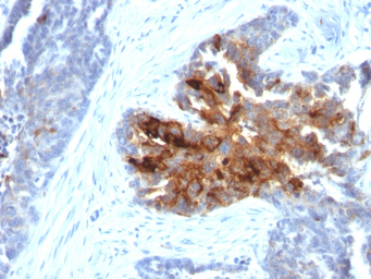 Anti-TAG72 antibody [CA72/2869R] used in IHC (Paraffin sections) (IHC-P). GTX02764