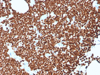 Anti-DNA antibody [rDSD/4565] used in IHC (Paraffin sections) (IHC-P). GTX02765