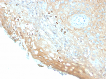 Anti-Human Papillomavirus type 16 L1 antibody [HPV16/2058R] used in IHC (Paraffin sections) (IHC-P). GTX02771