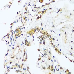 Anti-BAG3 antibody used in IHC (Paraffin sections) (IHC-P). GTX02777