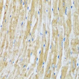 Anti-BAG3 antibody used in IHC (Paraffin sections) (IHC-P). GTX02777