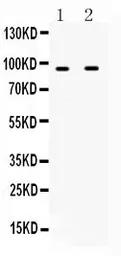 Anti-Interferon gamma Receptor 1 antibody used in Western Blot (WB). GTX02780