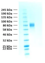 Human FGFR2 alpha IIIb (extracellular region) protein, His tag. GTX02783-pro