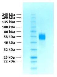 Human FGFR4 (extracellular region) protein, His tag. GTX02787-pro