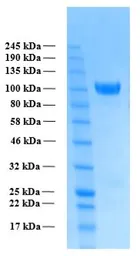 Human APP alpha (extracellular region) protein, His tag. GTX02796-pro