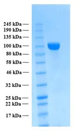 Human APP beta (extracellular region) protein, His tag. GTX02797-pro