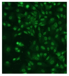 Anti-Estrogen Receptor alpha antibody [SC1] used in Immunocytochemistry/ Immunofluorescence (ICC/IF). GTX02805