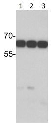 Anti-Estrogen Receptor alpha antibody [SC1] used in Western Blot (WB). GTX02805