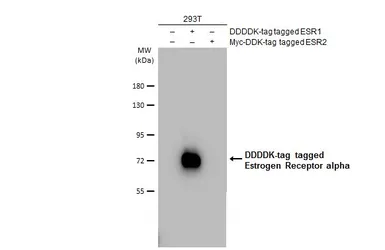 Anti-Estrogen Receptor alpha antibody [SC1] used in Western Blot (WB). GTX02805