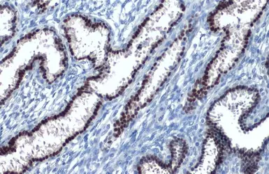 Anti-Estrogen Receptor alpha antibody [SC1] used in IHC (Paraffin sections) (IHC-P). GTX02805