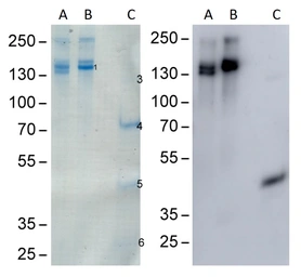Anti-C3 antibody [M68] used in Western Blot (WB). GTX02807