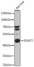 Anti-DGAT2 antibody used in Western Blot (WB). GTX02814