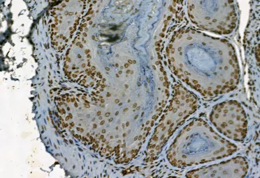Anti-NAK / TBK1 (phospho Ser172) antibody used in IHC (Paraffin sections) (IHC-P). GTX02815