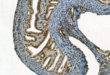 Anti-NAK / TBK1 (phospho Ser172) antibody used in IHC (Paraffin sections) (IHC-P). GTX02815