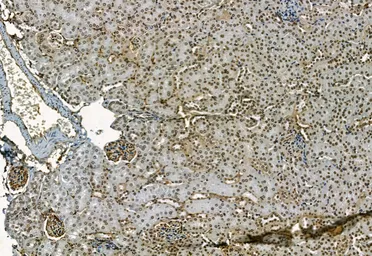 Anti-NAK / TBK1 (phospho Ser172) antibody used in IHC (Paraffin sections) (IHC-P). GTX02815