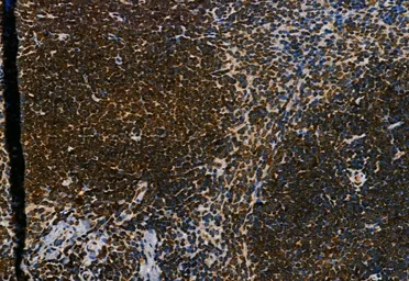 Anti-NAK / TBK1 (phospho Ser172) antibody used in IHC (Paraffin sections) (IHC-P). GTX02815
