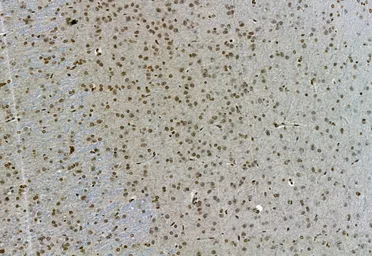 Anti-NAK / TBK1 (phospho Ser172) antibody used in IHC (Paraffin sections) (IHC-P). GTX02815